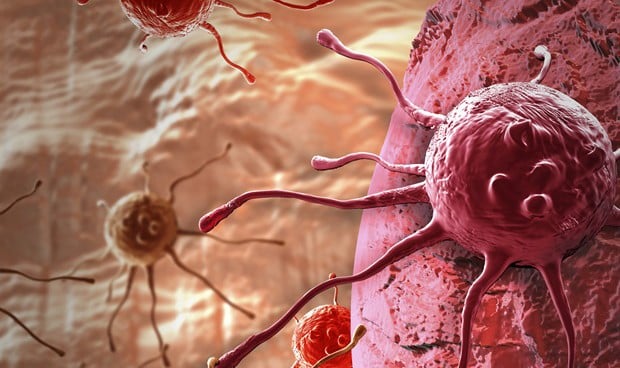 Los investigadores utilizaron los datos del estudio Global Burden of Disease Study de 2019, analizando las tasas de 29 cánceres diferentes en 204 países.