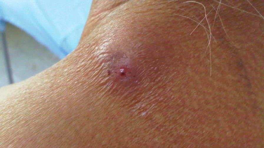 EE.UU. emite una alerta sanitaria por la presencia del gusano barrenador en Nicaragua